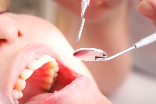 歯科治療中の患者の口内検査
